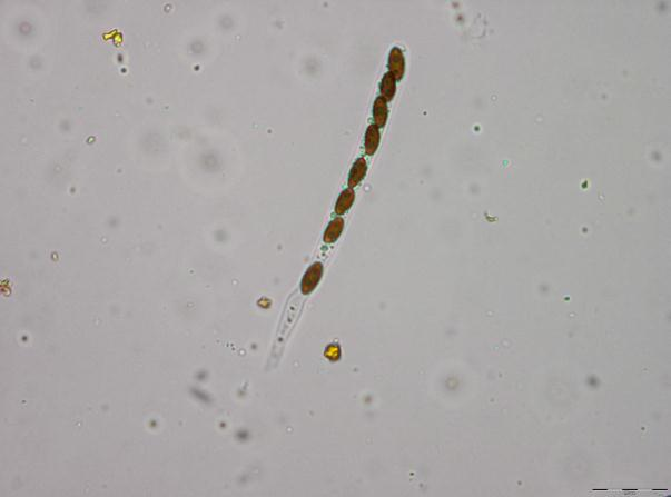 Stubbehornordenen: Hypoxylon salicicola.