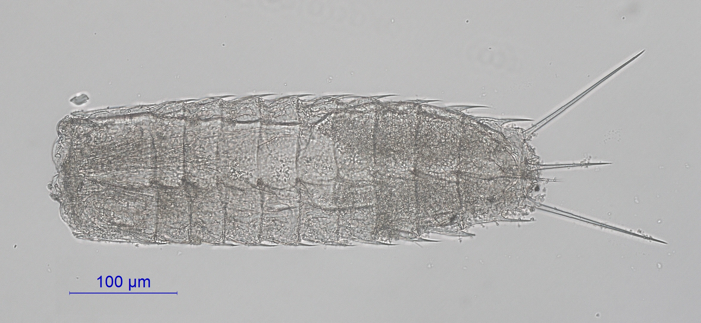 Cephalorhyncher: Paracentrophyes quadridentatus.