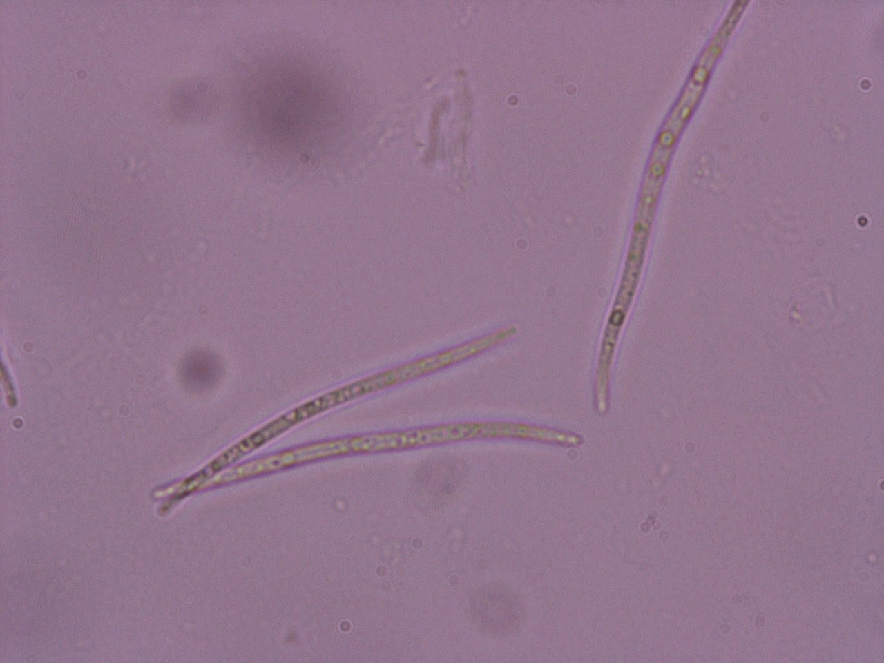 Pærelavordenen: Rhaphidicyrtis trichosporella.